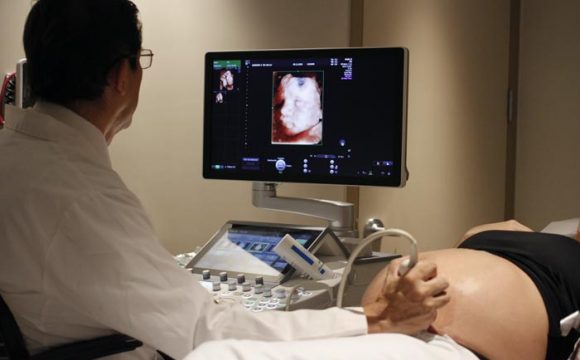 Ecografías 3D