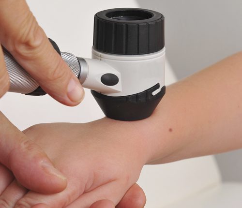 Centro de Salud abre especialidad de Dermatología